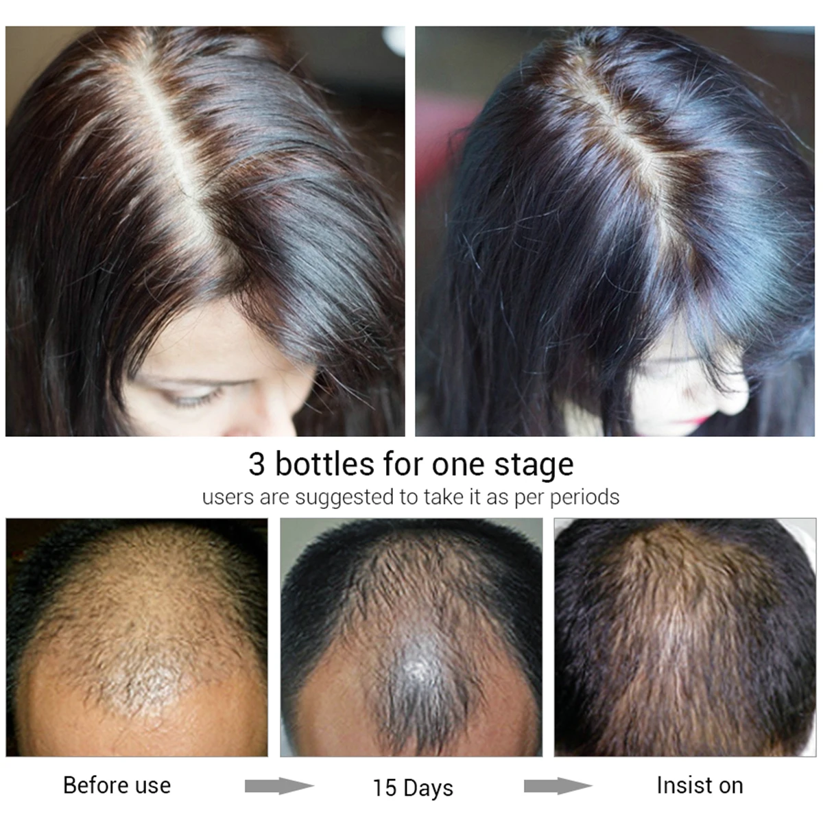 Эссенция для роста волос 20 мл спрей против выпадения лечение питание жидкий Уход