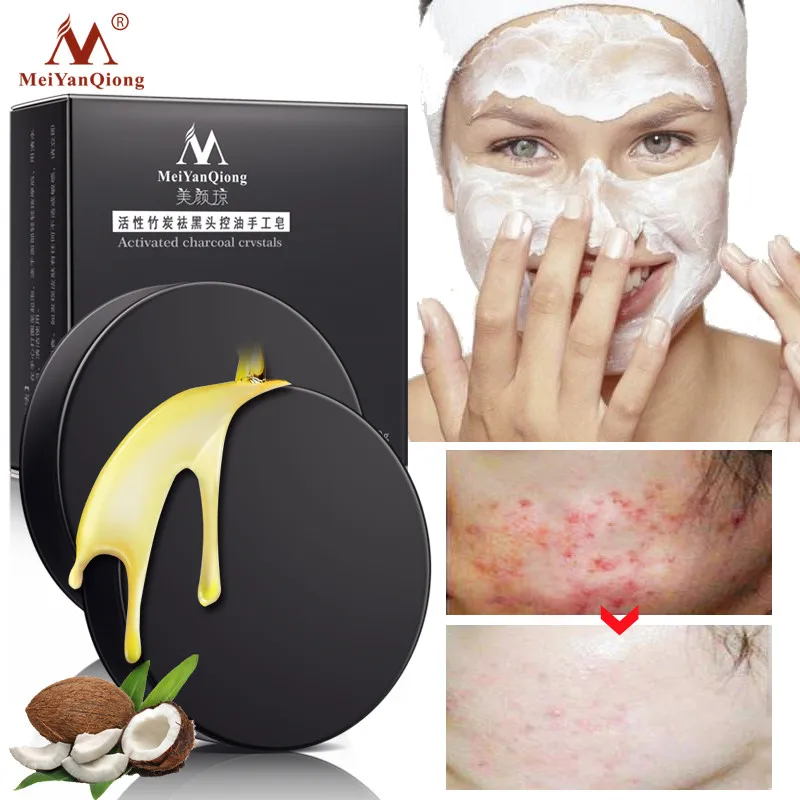 

Activated Charcoal Handmade Soap Deep Cleansing Moisturizing Remove Blackhead Oil Control Whitening Shrink Pores Face Skin Care