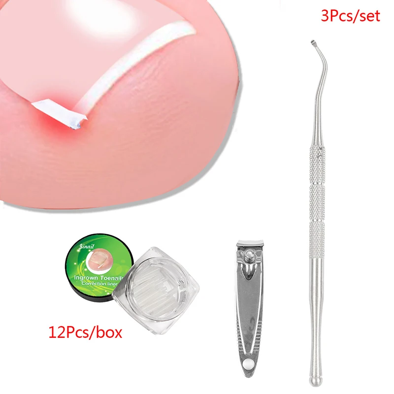 

1 Set Ingrown Toe Nail Straightening Clip Wire Fixer Toenail Pedicure Curved Correction Elastic Tool Toenail Patches Patch
