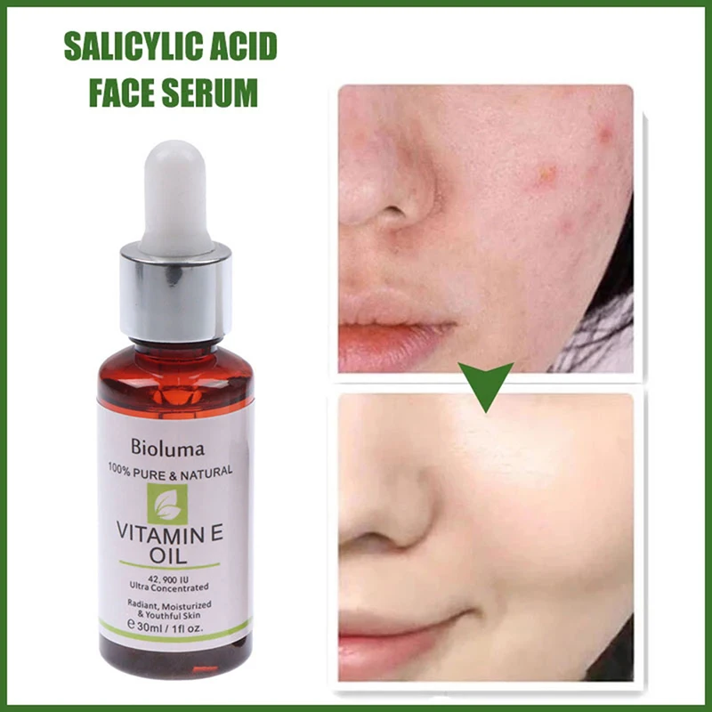 

Vitamin E Oil Visibly Reduce Scars Stretch Marks Dark Spots & Wrinkles Remove Skin Essential Oil Pure Remove Ance Burn Scar