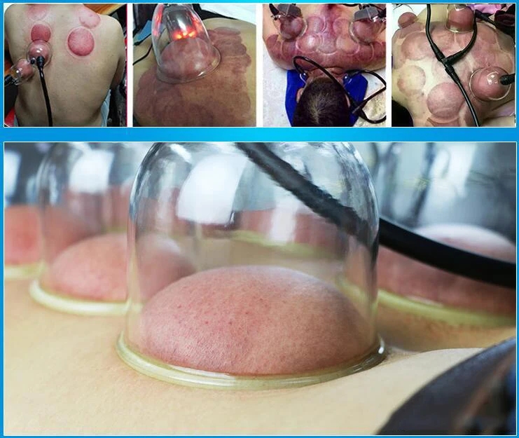 Электрический массажер для увеличения груди аппарат расслабления уход за