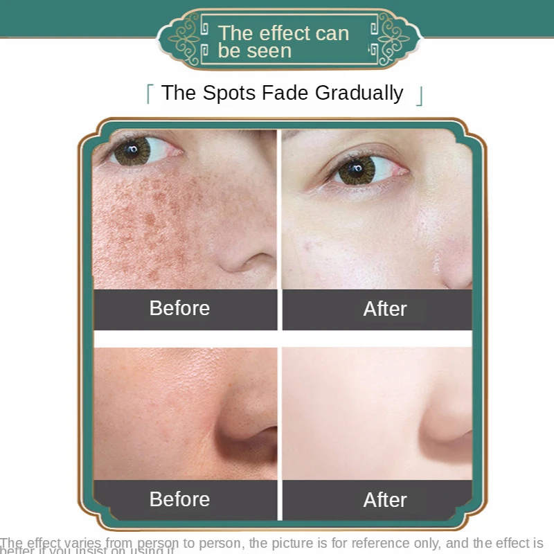 

Powerful Whitening Freckle Cream Chinese Herbal Plant Face Cream Remove Freckles And Dark Spots 20g Skin Whitening Cream