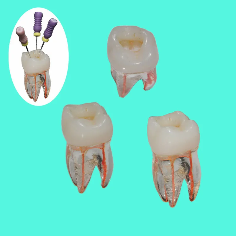 резцы клыки премоляры моляры анатомия. жевательный зуб корни. корни зубов верхней челюсти. жевательный зуб корни. жевательный зуб корни.