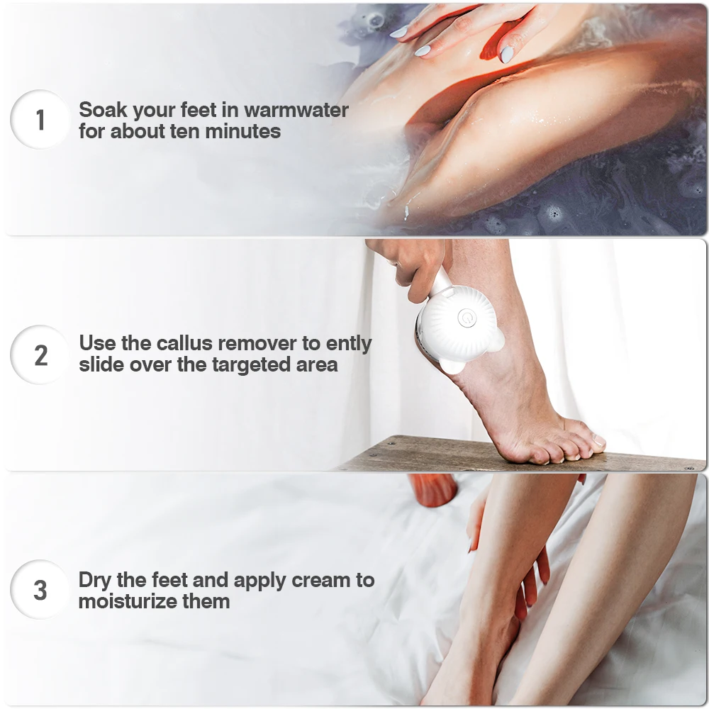 

Electric Vacuum Adsorption Foot Grinder Fast Shipment USB Electronic Foot File Pedicure Tool Dual-Speed Callus Remover Foot Care