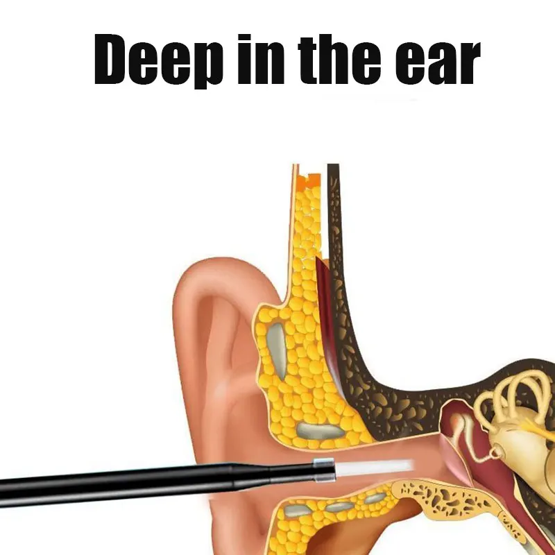 

Earwax Removal LED Otoscope Ear Cleaning Endoscope Spoon Mini Camera Ear Picker Ear Wax Removal M2