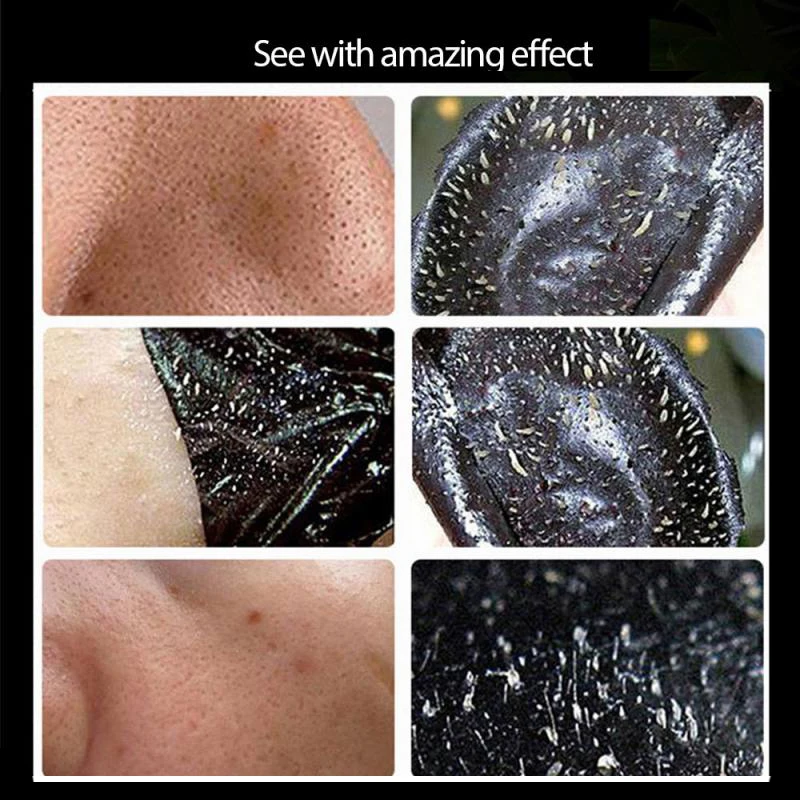 Маска для удаления черных точек на носу маска крем сужения поры акне удаление