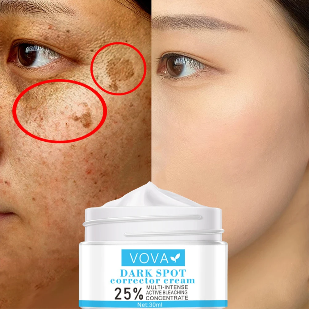 VOVA Dark Spot Removal Whitening Skin Cream Remove Melasma Acne Pigment Melanin Pigmentation Moisturizing Gel 30g |