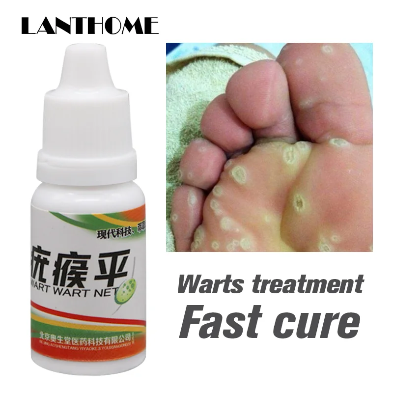 Black Dots Mole Wart Skin Tag Remover 12 Hours Tu Kill Liquid Medical Foot Corn Removal Care Solution |
