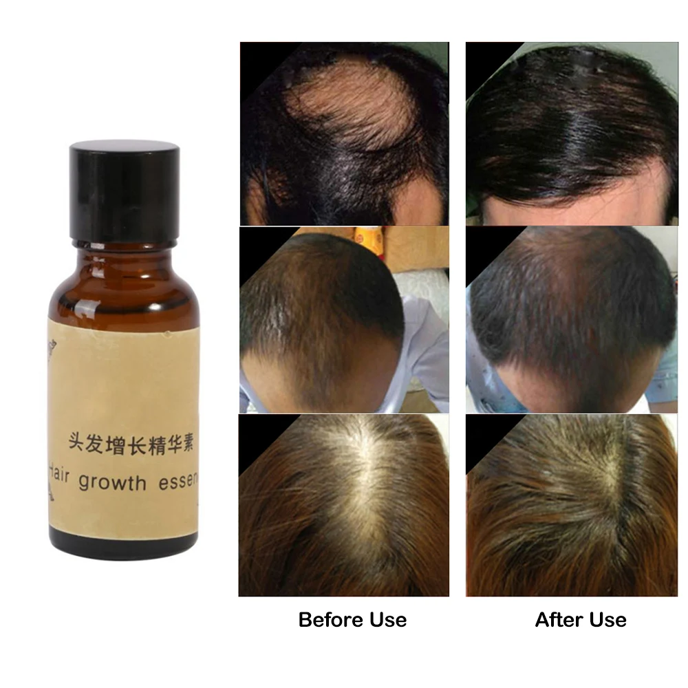 Жидкий Усилитель роста волос выпадение утолщение лечение формула сыворотка для