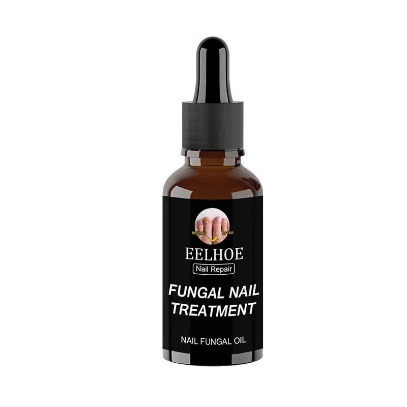 

30ml Fast Fungal Nail Treatments Serum Anti-Fungal Nail Sensitive Herb Toe Fungus Onychomycosis Paronychia Foot Repair Essences