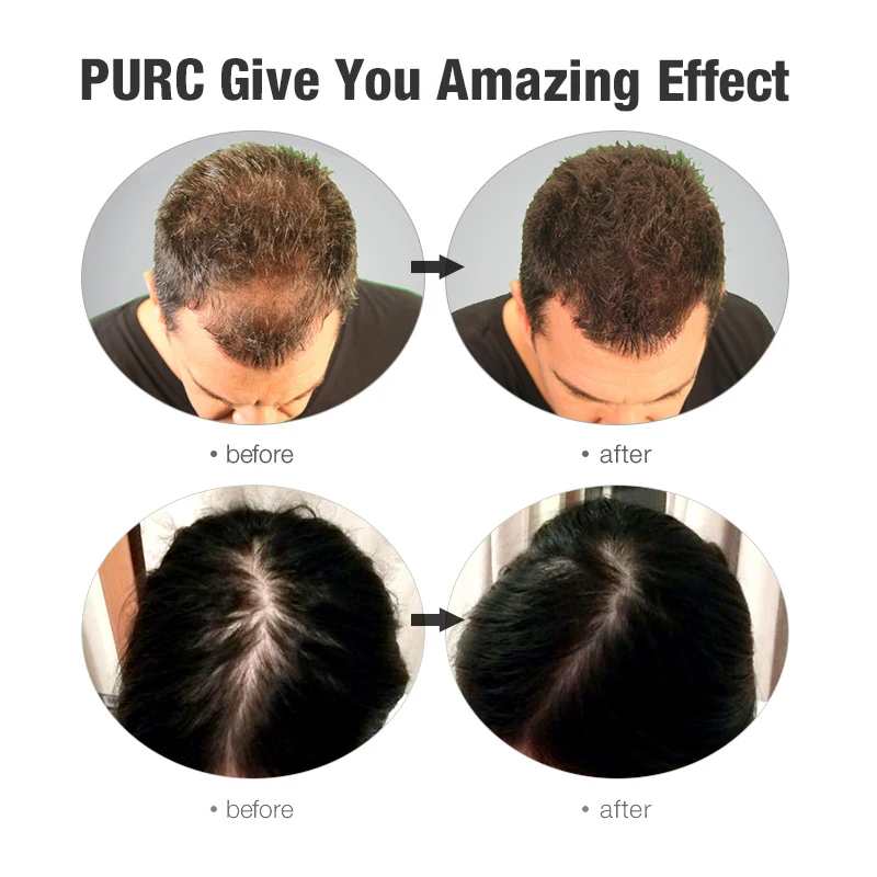 

PURC Grow Hair Care Set Hair Growth Oil Thickening Shampoo & Hair Conditioner Anti Hair Loss Treatment Free Shipping