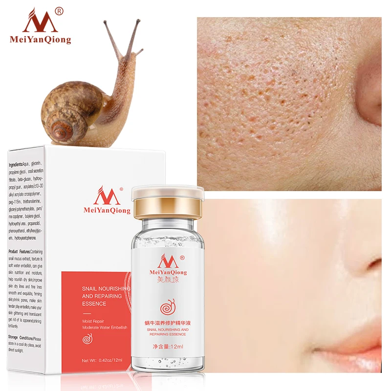 

Snail Face Serum Hyaluronic Acid Nourishing Moisturizing Shrink Pores Repair Essence Anti-Wrinkle Anti-Aging Whitening Skin Care