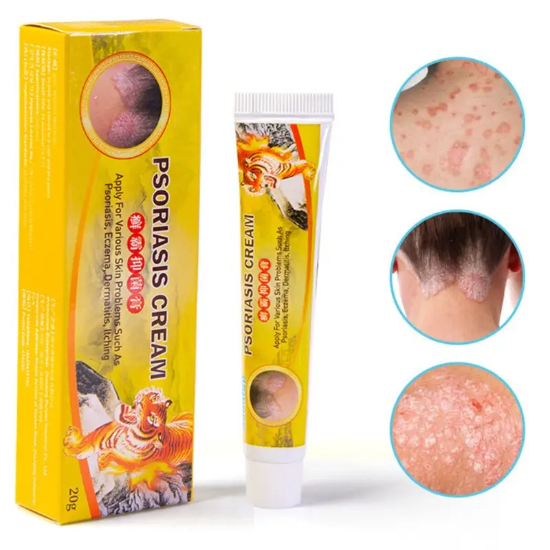 

20ml Herbal Psoriasis Cream Bacteriostasis Eczema Dermatitis Itching Ointment U2JD
