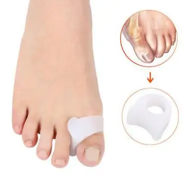 1 штука в вальгусной ортопедической деформации пальцы ног бедра кости ортопеды