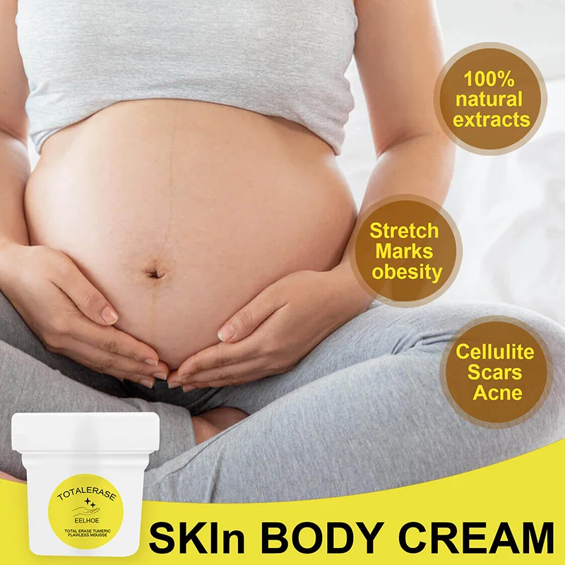 Anti Cellulite Cream Moisturizing Belly Skincare Fast Weight Increasing Skin Stretch Mark Prevention For Women Men Massage
