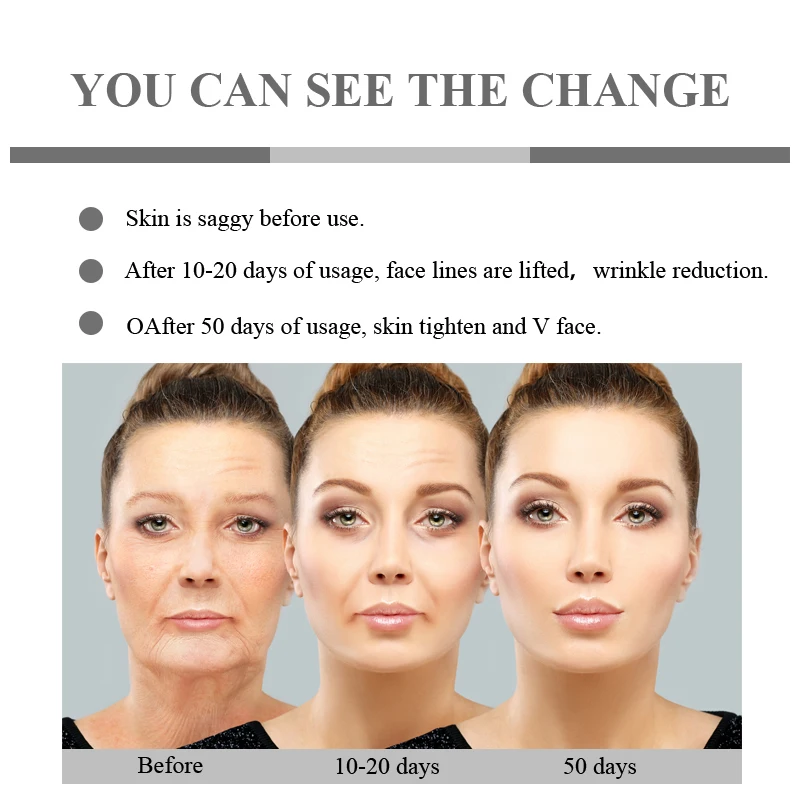 Для домашнего использования инфракрасный термаж для лица RF радиочастота