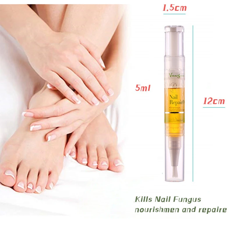 LANBENA 1 шт. грибковая ручка для лечения Ногтей паронихикоз инфекция ногтей