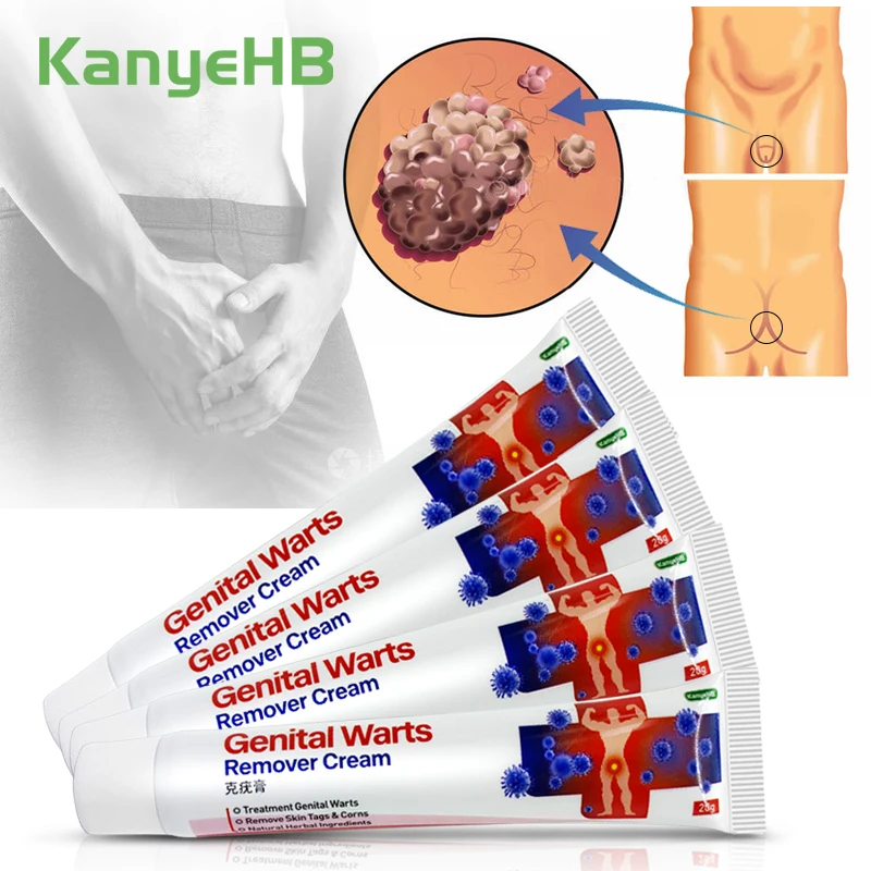 4 шт. пластырь для удаления бородавок на пенисе |