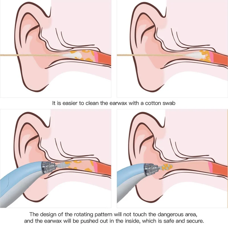 Детский очиститель для ушей инструмент удаления воска светильник ушной