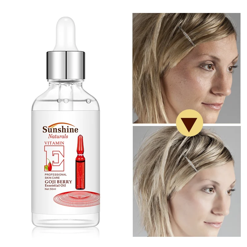 Дереза обыкновенная эфирные масла увлажняющее масло контроль укрепляющее уход