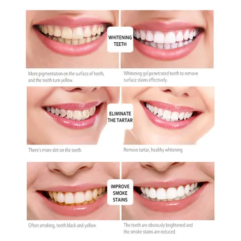 ARTISCARE Отбеливающая ручка для зубов