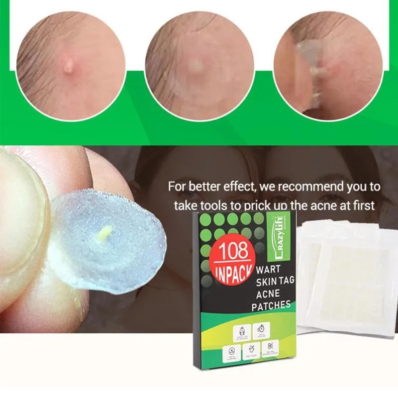 108 шт. накладки на прыщи невидимые наклейки лечение прыщей мастер удаления