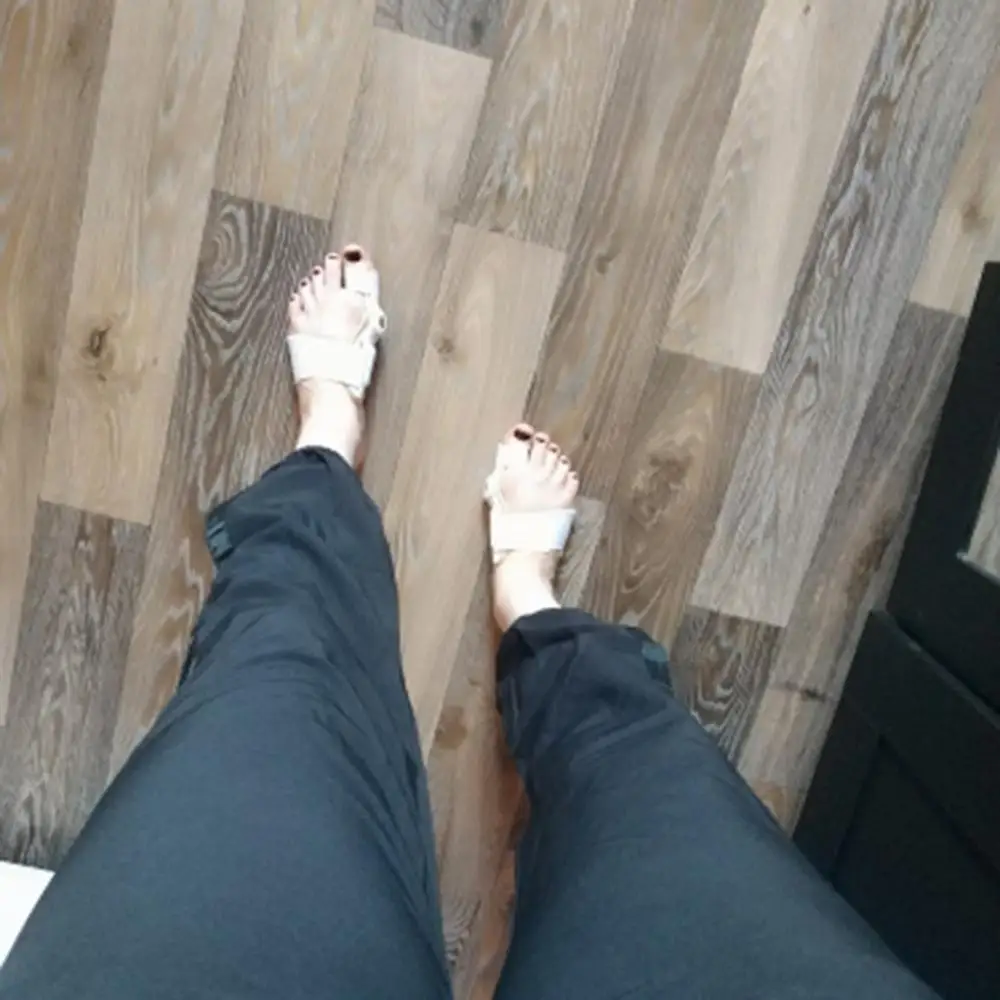 1 шт. защита для бурсит стопы ортопедический уход инструмент педикюра корректор