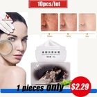 10 шт Сильные эффекты мощный крем для отбеливания веснушек удаление меласмы акне пигмент меланин темных пятен уход за кожей лица крем