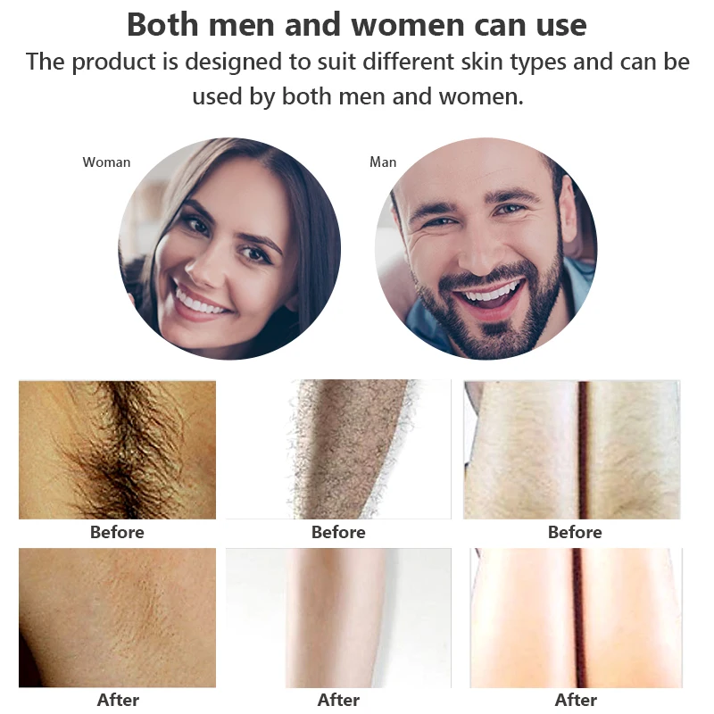 

T4 Laser Hair Removal ICE Cold IPL Epilator Permanent Depilador a Laser Bikini Trimmer Electric Depilador Laser Hair Remover
