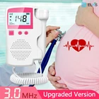 Допплер ультразвуковой для фетальной беременности, монитор сердцебиения, домашний сонар, стетоскоп для беременных женщин, детектор без радиации для беременных  джемпер  для беременных женщин  доплер для беременных  узи