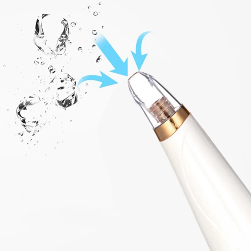 

Blackhead Remover Vacuum - Blackhead Suction Device with 3 Adjustable Suction Levels and 5 Removable Probes