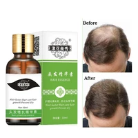 fast hair growth essence hair loss products hair growth fibras cabelo shampoo cremes de tratamento para cabelos hair care