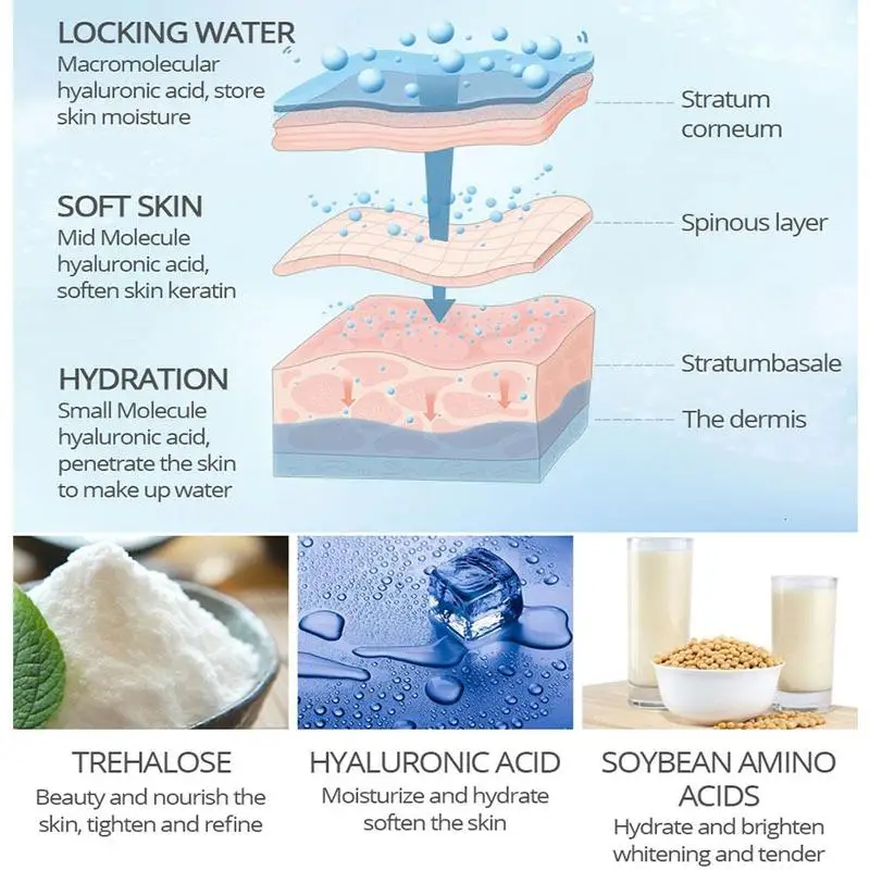 

Effective Whitening Freckle Cream Remove Melasma Acne Spot Pigment Melanin Dark Spots Pigmentation Moisturizing Gel Skin Care