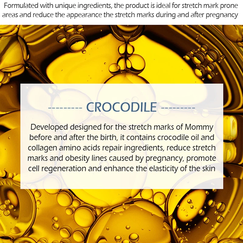 Яркий гламурный крокодиловый растягивающийся крем для удаления шрамов