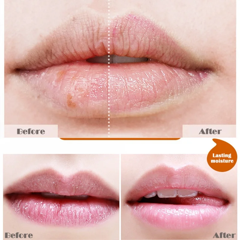 

Plant Extracts Lip Balm Colorless Moisturizing And Nourishing Delivering Glamour Protecting Your Lips