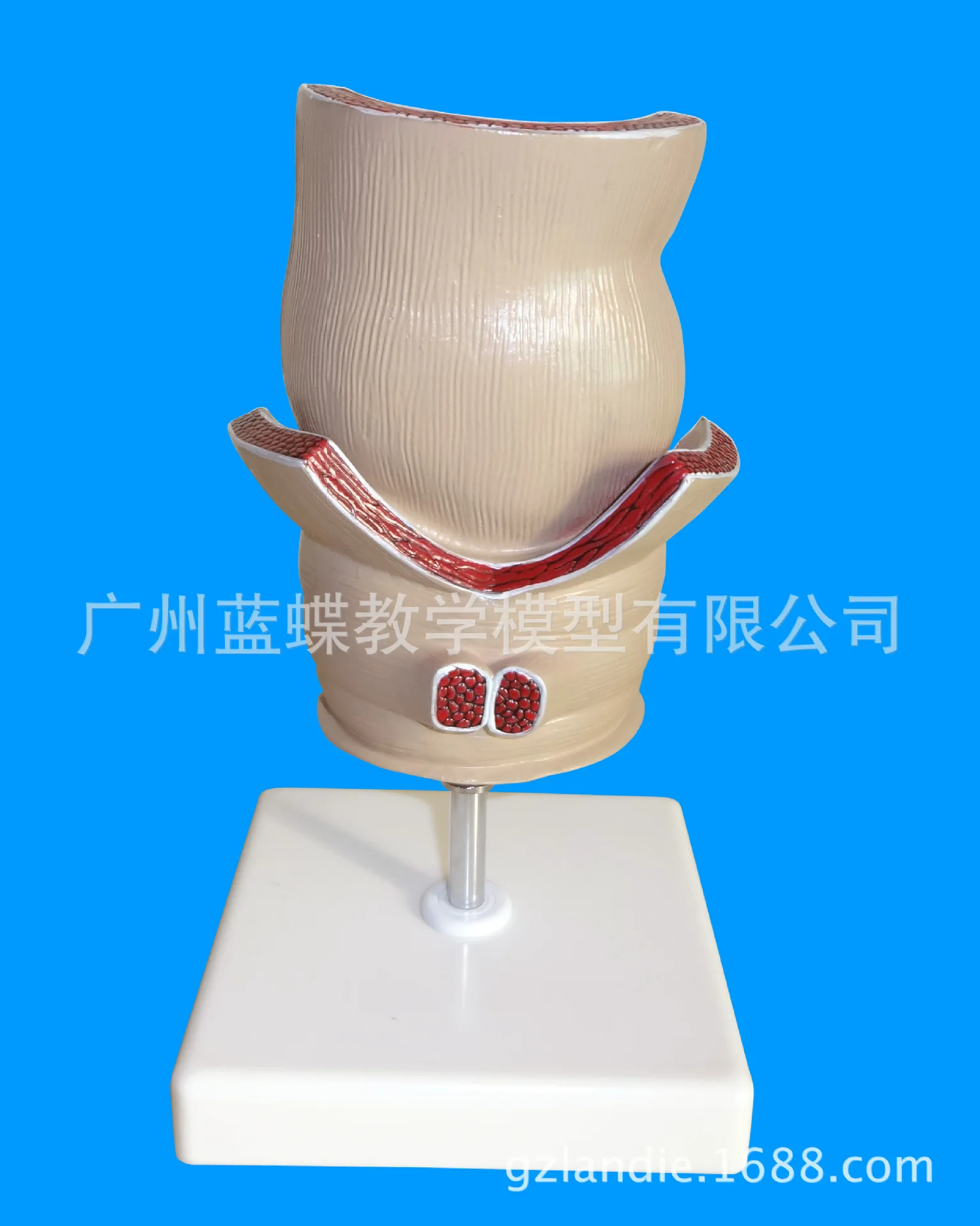 5-кратная анатомия человека модель поражения ректального геморроя внутренняя