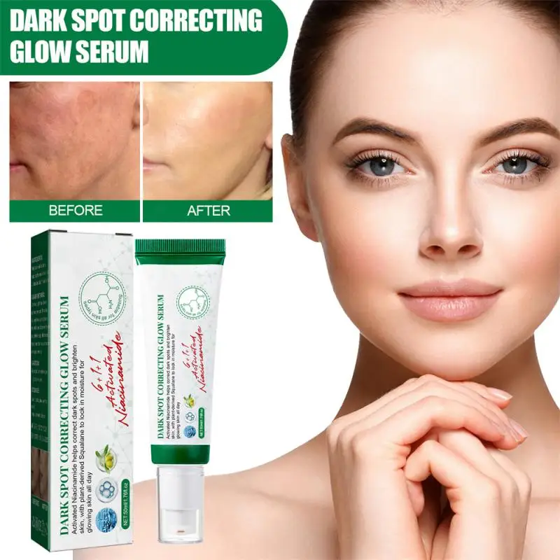 

Freckle Whitening Essence Dark Spot Corrector Skin Whitening Fade Cream Lightening Blemish Removal Serum Spots Freckles Face