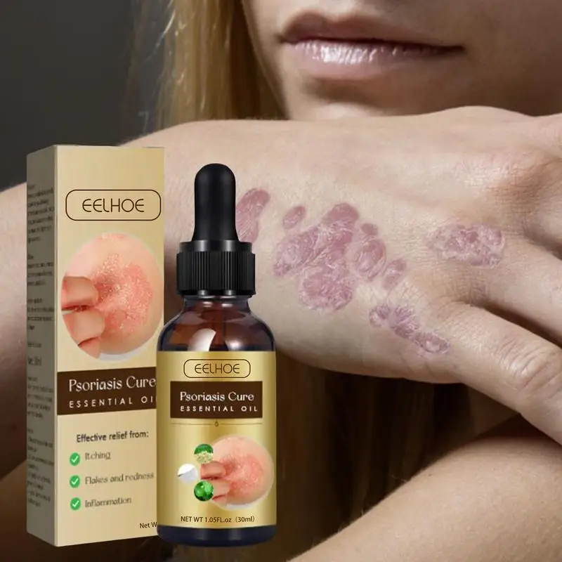 

Psoriasis Repair Skin Essential Essence Removing Dark Spots Repairing Dull Tone Moisturizer 30ml Organic Facial Skin Essence