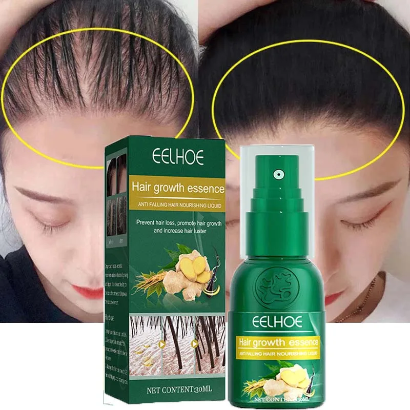Products Natural Anti Hair Loss Serum Prevent Baldness Treatment Fast Grows Nourish Damaged Hair Care