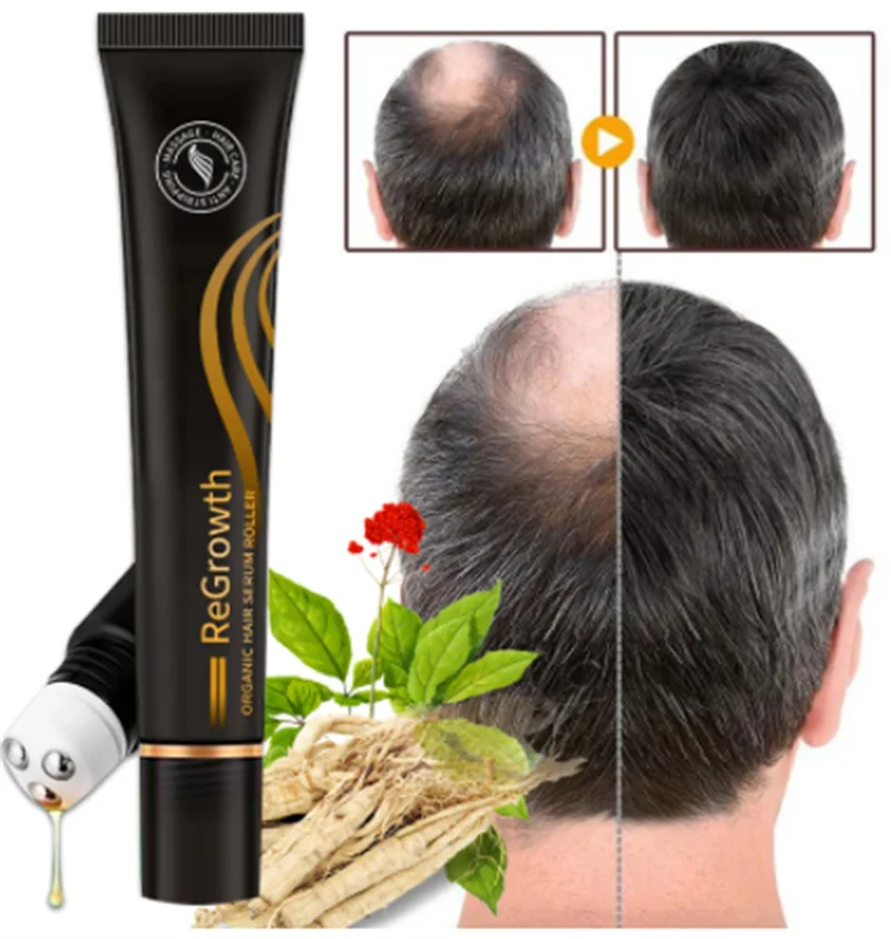 

Natural Hair Growth Essential Oil Anti-Hair Loss Essence Beauty Products Roller Massage Scalp Hair Care Repair Damaged Hair 20ml