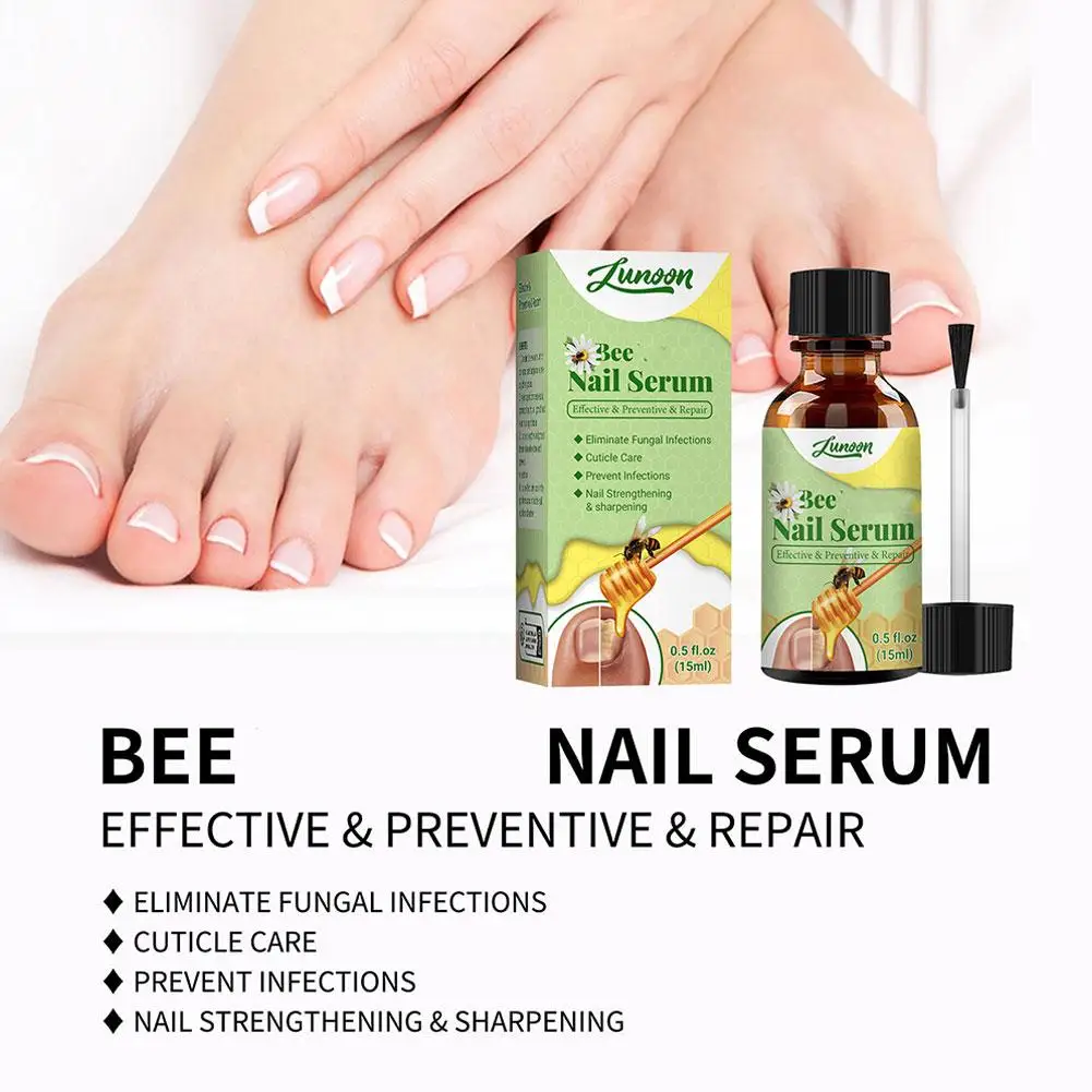 Сыворотка для лечения пчелиного грибка ногтей, средство для ...