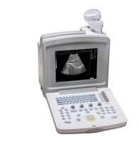 medical ultrasound instruments mobile pregnancy ultrasound machine portable doppler ultrasound for human