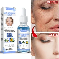 anti wrinkle anti aging face serum oil control lift firm lighten fine lines fade acne marks moisturizing whitening essence 30ml