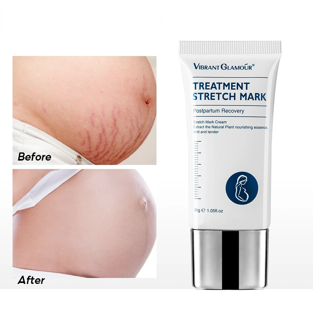 30g Stretch Mark Removal Scar Cream No Trace Proliferation Repair Moisturizing Repair Cream