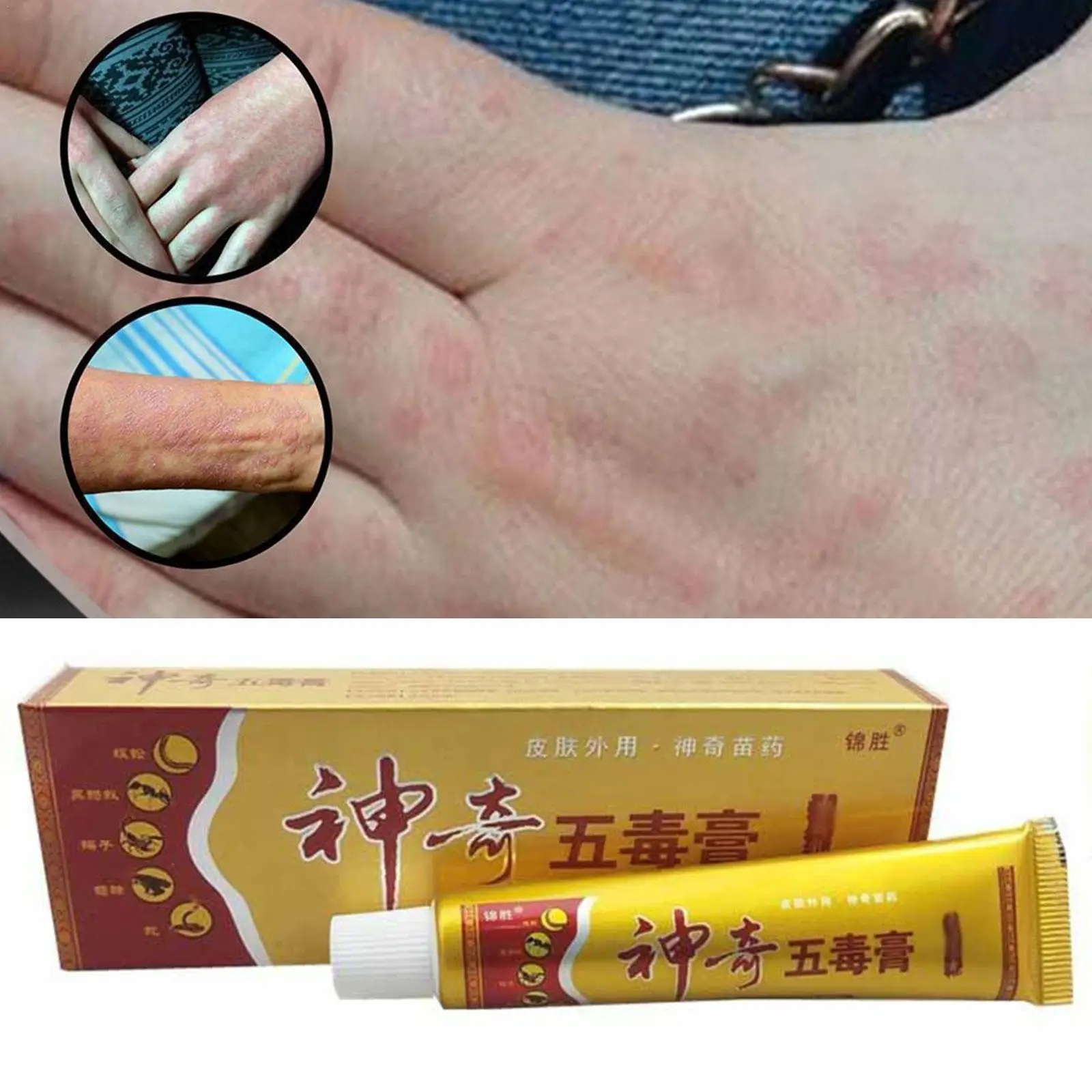

1pcs Treatment Psoriasis Cream Antibacterial Antipruritic Dermatitis Eczema Herbal Ointment Anti-itch Medical Plaster