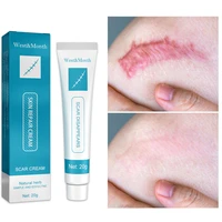 herbal scar removal cream remove stretch marks burn surgical spots smooth moisturizer fade dark scars body skin care