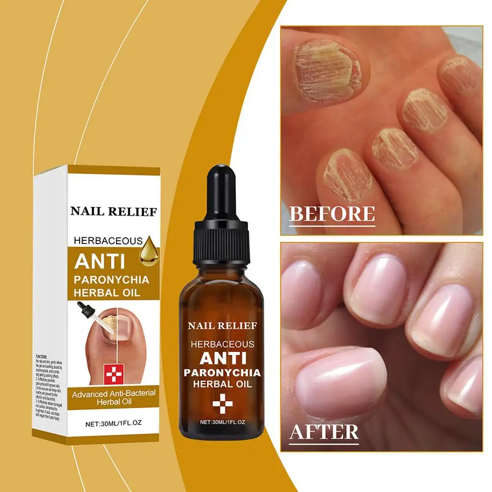 Средство для лечения Ногтей от грибков эссенция восстановления ногтей на ногах