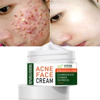 effective acne removal cream treatment acne scar spots oil control shrink pores whitening moisturizing anti acne face gel care