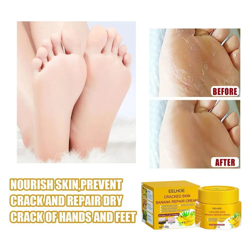 

20g Natural Banana Oil Moisturizing Cracked Heel Balm Anti-Drying Skin Ointment Repair Removal Dead Cream Skin Foot Smooth E9R8