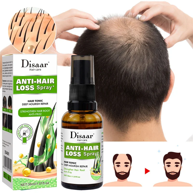 

Hair Growth Spray Anti Hair Loss Essence Ginger Strong Moisturizing Nourish Root Hair Serum Hydrating Repair Scalp Care 30ml